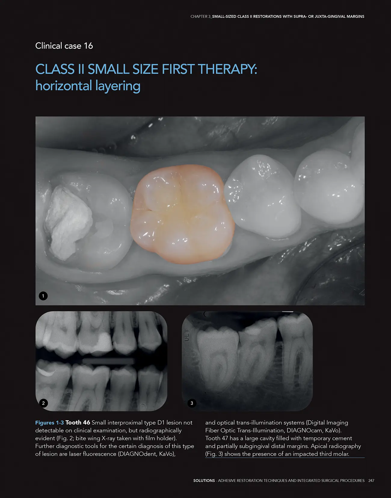 Carrera, impaginazione book Solutions per Edra